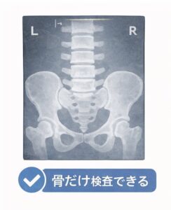 「腰のレントゲン画像。骨の状態を確認する検査であることを示しているイメージ」