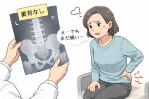 レントゲンで「異常なし」と説明を受けても、腰の痛みに悩む女性のイラスト