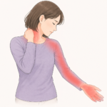 首から肩、腕、手にかけて痛みやしびれがある女性のイラスト